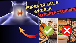 Hyperthyroidism Diet Plan  Hyperthyroidism Foods to Eat amp Foods to Avoid  Hyperthyroidism Symptoms [upl. by Rutledge500]