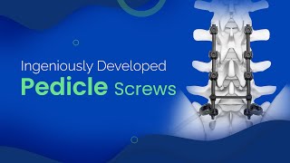 Advanced Pedicle Screws  Spine Implants [upl. by Yensehc372]