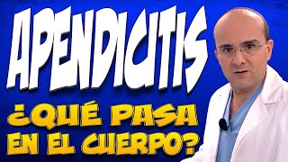 APENDICITIS  ¿Qué pasa dentro del cuerpo de quienes la padecen [upl. by Jorie]