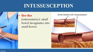 INTUSSUSCEPTION video [upl. by Ahtnahc]