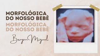 Morfológica do nosso bebê 👶🏽 [upl. by Connors716]