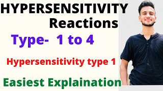 Hypersensitivity reactions  Hypersensitivity type 1 Hypersensitivity reactions type 1234 [upl. by Aerehs95]