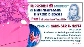 Thyroid dysfunction and thyroiditis  lecture شرح محاضرة [upl. by Mcleroy]