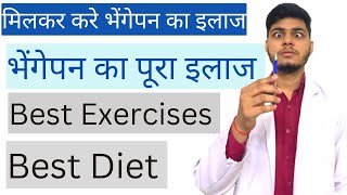 भेंगापन ठीक करने के लिए व्यायाम  Exercises and diet to Cure Squint  100 Working [upl. by Seagrave]