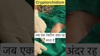 Cryptorchidism l Dr Umar Khan [upl. by Rhoads]