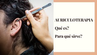 Auriculoterapia qué es y para qué sirve [upl. by Caldeira692]