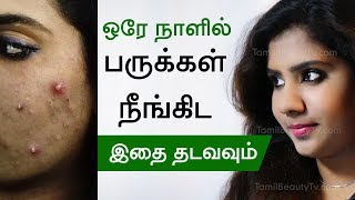 How to remove pimple  Home remedies for pimples  Beauty Tips in Tamil [upl. by Kerianne]