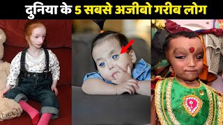 दुनिया के 5 सबसे अजीबो गरीब लोग  5 most strange people in the world  unusual people amazing fact [upl. by Fidele]