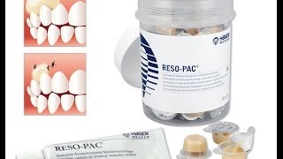 ResoPac ® by Hager amp Werken  Wundschutzpasteperiodontal dressing [upl. by Thompson]