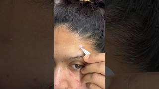 Pimple patch peel off acne pimplepatch pimplespots acnescars pimplepatches cystpoping cystic [upl. by Evad338]