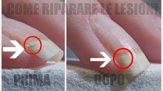 Come riparare le lesioni metodo colla e fibra di vetro nail glass fiber diy repair fai da te [upl. by Erlene]