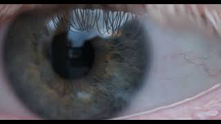 Testing the Olympus 60mm F28 Macro lens on an eye [upl. by Sonia]