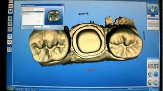 Cerec 3D Crown Master Mode stepbystep [upl. by Volnay]