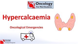 Hypercalcaemia of malignancy [upl. by Ylrae]