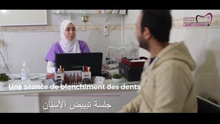 blanchiment dentaire تبييض الأسنان [upl. by Ayotan]