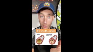 Chronic Bronchitis vs Emphysema  EMTParamedic  The Paramedic Coach Shorts [upl. by Mildred1]