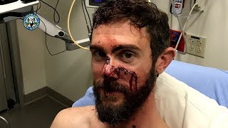 Colorado Man Travis Kauffman Survives Mountain Lion Attack [upl. by Emolas]