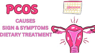 Polycystic Ovary Syndrome  PCOS  Causes  Sign  Symptoms amp Dietary Treatment [upl. by Zenobia521]