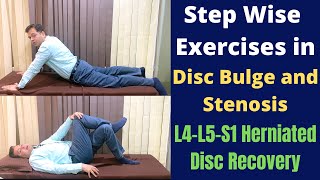 TWISTING her SPINE  Slipped Disc  Sciatica Back Pain Treatment  Indian Chiropractic  Dr Ravi [upl. by Denny]