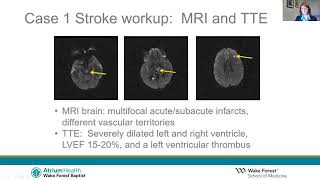 Stroke and Pregnancy [upl. by Pavier]