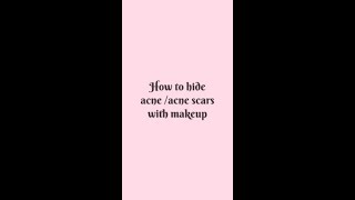 How to cover acne scars or open pores with makeup  Base Makeup for Acne prone skin [upl. by Nirtiac978]