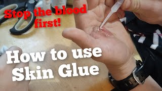 How to Glue Skin with super glue Deep wound treatment Blood in the video [upl. by Ilam937]