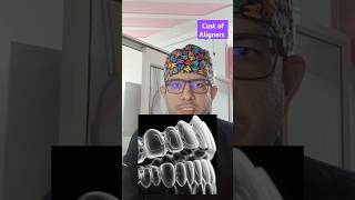 Cost of Aligners  What are Aligners  Briefly explained smile viralvideo youtubeshorts [upl. by Carlee]