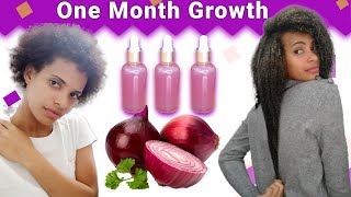 Onion Juice For Hair Growth 😱BEFORE AND AFTER RESULTS [upl. by Pantheas]