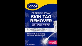 NEW Scholl Freeze Away Skin Tag Remover effectively removes skin tags in as little as 1 treatment [upl. by Adnamal]