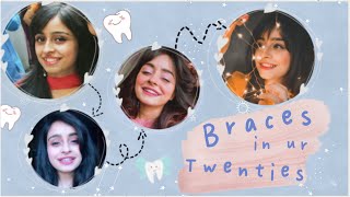 Braces in Your Twenties  Story Time  Vitasta Bhat [upl. by Mareah]