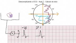 Descomplicando o ECG  Aula 7  Cálculo do eixo [upl. by Baggett]