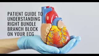 Understanding Right Bundle Branch Block RBBB on Your ECG A Patient Guide [upl. by Oterol]