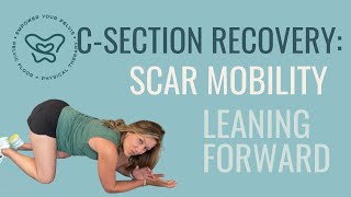 Csection Recovery Scar Mobility in Leaning Forward Position [upl. by Gen74]