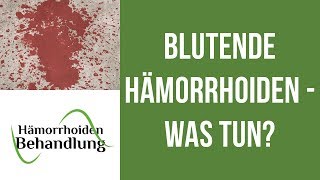 Blutende Hämorrhoiden  Was kann man tun wenn die Hämorrhoiden bluten [upl. by Thurstan603]