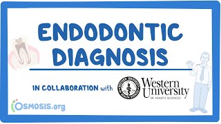 Endodontic Diagnosis in Collaboration w Western University [upl. by Atinek]