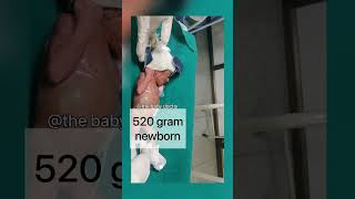 520 gram preterm newborn  so tiny amp gentle  beautiful baby the baby doctor babyvideos ytshorts [upl. by Ardin]