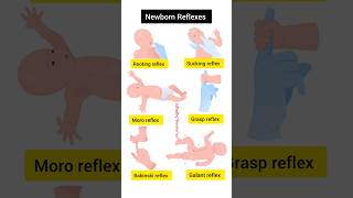 Newborn Reflexes Normal Baby Reflex Baby Reflexes nursing newbornbaby reflexes neet shorts [upl. by Adoh]