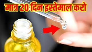 सिर्फ 2 बूँद सोने से पहले नाभी में डाल दो सुबह तक ये जबरदस्त फायदे मिलेंगे  Caster Oil [upl. by Anailli]