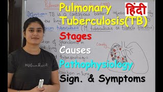 Pulmonary Tuberculosis in Hindi  Stages  Causes  Pathophysiology  Sign amp Symptoms [upl. by Esiuol]