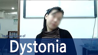 DystoniaCervical dystoniaSpasmodic Torticollis  사경증 치료사례  근긴장이상증 [upl. by Draillih726]