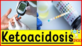 ketoacidosisdiabetes ketoacidosis signs and symptoms Diagnosis [upl. by Rojas588]