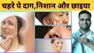 चहरे पे दाग़ धब्बे और छाईया दूर सिर्फ एक क्रीम से।skinlite cream uses side effects [upl. by Karilla899]