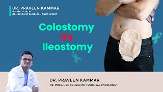 Colostomy Vs Ileostomy  Colostomy vs Ileostomy Difference  Dr Praveen Kamar Mumbai [upl. by Elam943]