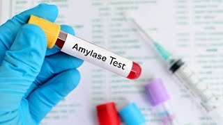 Serum Amylase Test Procedures [upl. by Oiznun194]