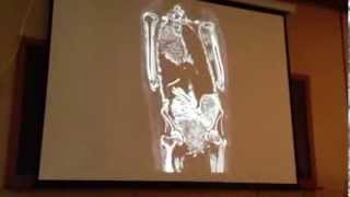 The Anatomy of a Mummy Part 2  Bob Briers Presentation at the 8th World Congress on Mummy Studies [upl. by Prowel]