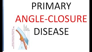 Ophthalmology Primary Angle Closure Disease Glaucoma PACG Suspect [upl. by Ettenuahs]