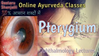 Pterygium अर्म in Hindi EnglishBAMSGeetaruGitaruBAMS final year subjectsAyurvedAyurveda [upl. by Breech498]