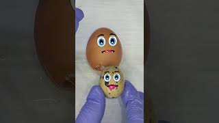 Egg gives birth 🥚  CSection  Babies Birth 🥰😱 Food surgery  Fruit surgery shorts [upl. by Zantos361]