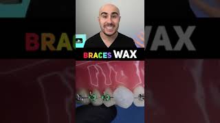 Braces Wax [upl. by Nessaj]