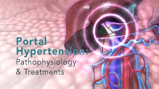 PORTAL HYPERTENSION Pathophysiology and Common Treatments [upl. by Salokcin]